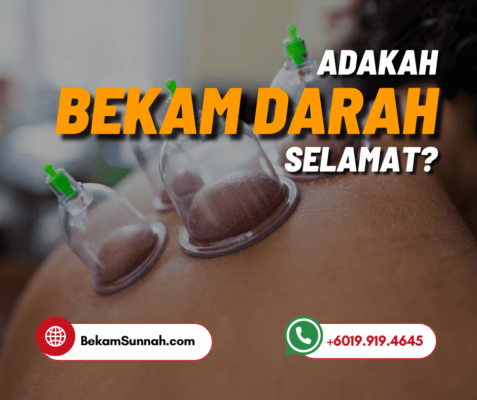 Adakah Bekam Darah Selamat?