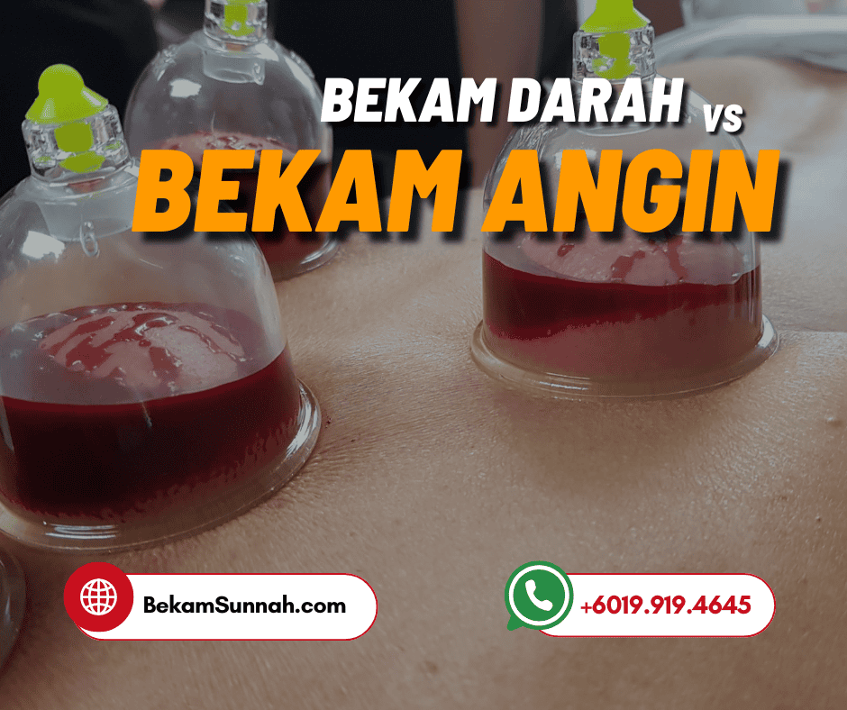 Bekam Angin vs Bekam Darah – Apa Beza & Mana Lebih Sesuai?