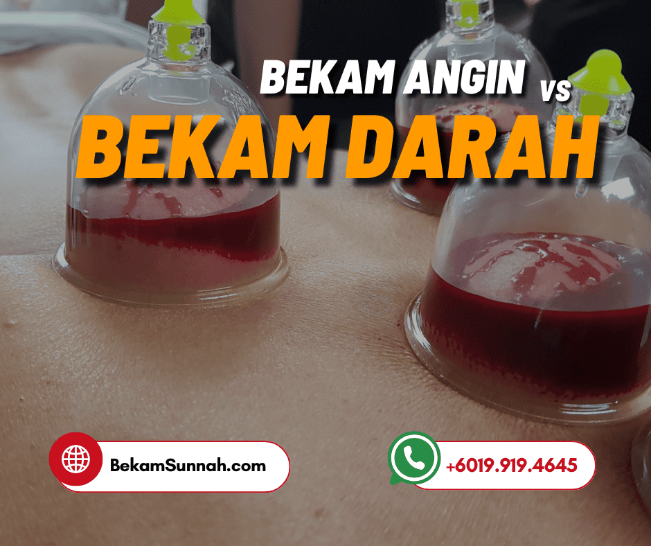 Bekam Darah vs Bekam Angin