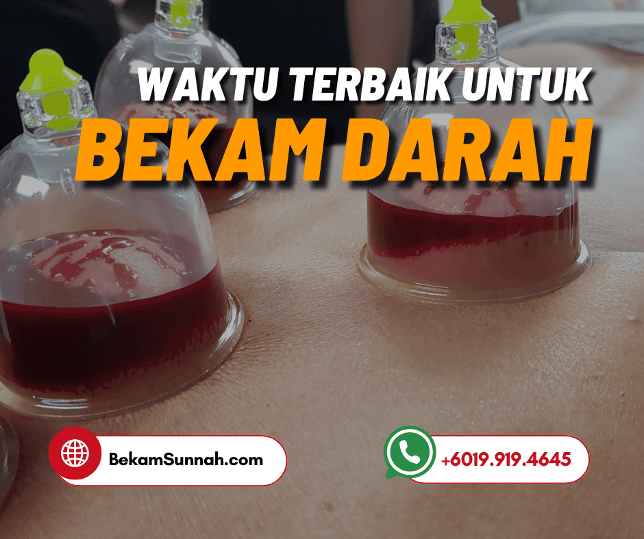 Bila Waktu Terbaik Buat Bekam Darah